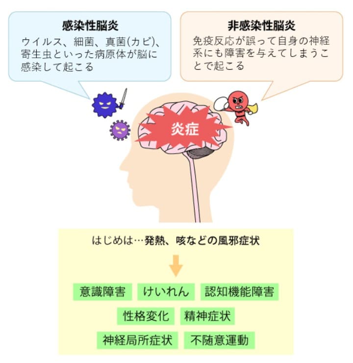脳炎の原因と症状